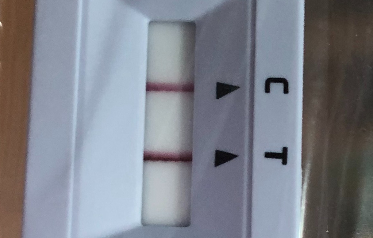 疫情下的他者哲學:一場全世界都加入,名為「倖存COVID-19」的行為藝術